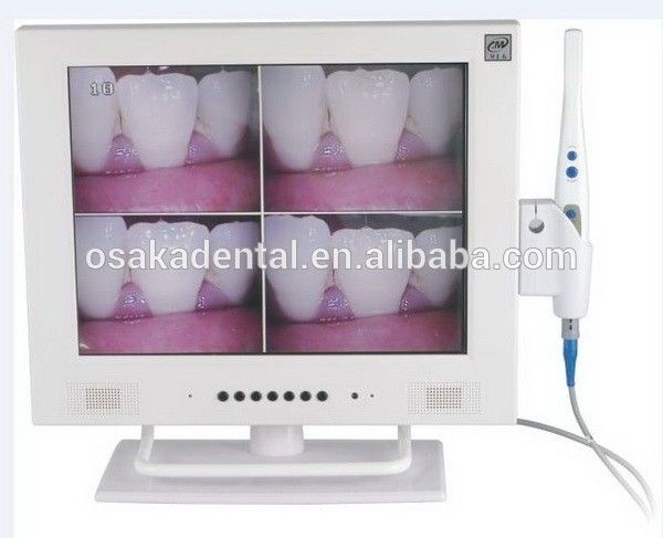 Cámara intraoral dental con pantalla de 15 pulgadas y Wi-Fi