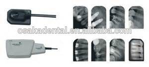 máquina de rayos x de tipo móvil dental
