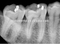 Montado en la pared dental con máquina de rayos X aprobada por CE