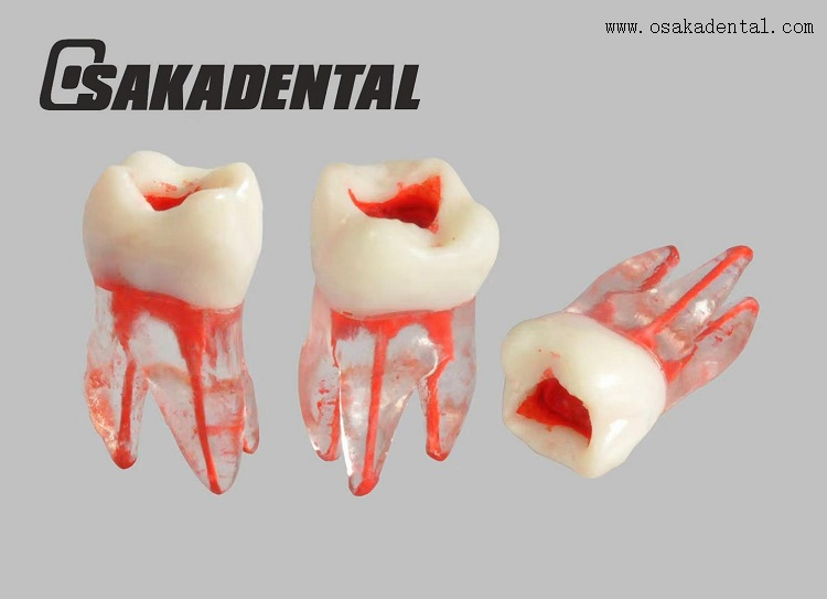Molde de estudio de dientes de conducto radicular dental